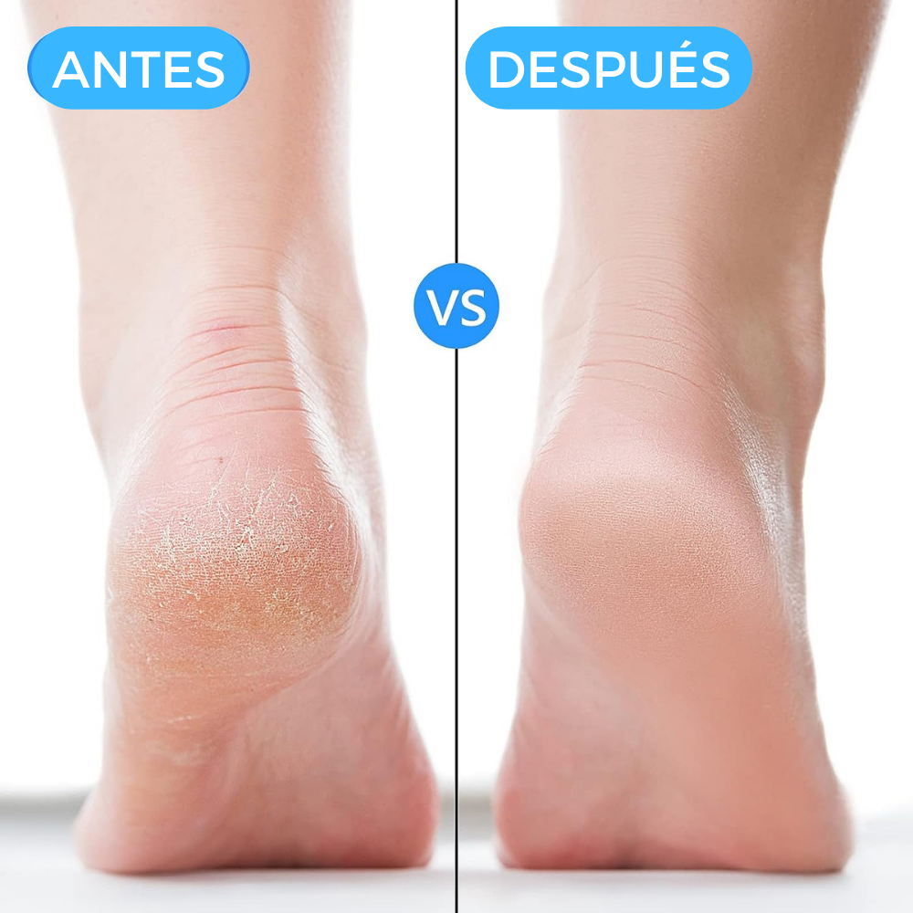 Talonera Terapéutica ajustable - PharmaFoot™